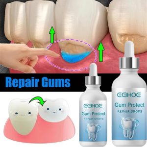 Advanced Gum Care Serum - Instant Relief for Tooth Sensitivity & Gum Irritation